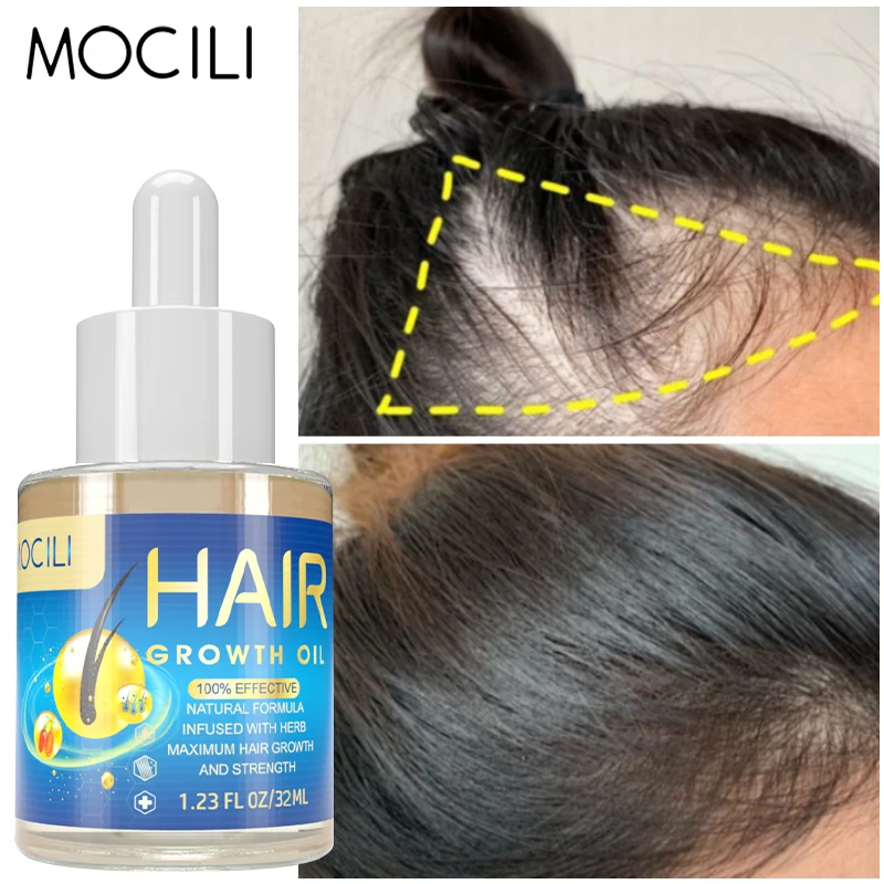 

Hair Growth Oil Prevent Hair Loss Repair Anti-Sparse Promote Hair Growth Nourish Dry Damaged Hair Care Hair Loss Treatment 32ml