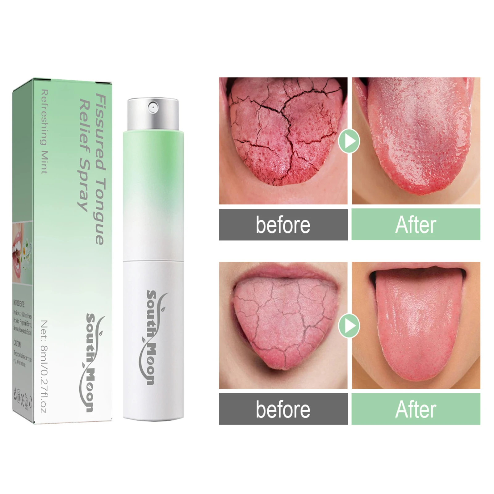 FissuredTongueReliefSprayCrackTongueReliefFreshBreathEliminate