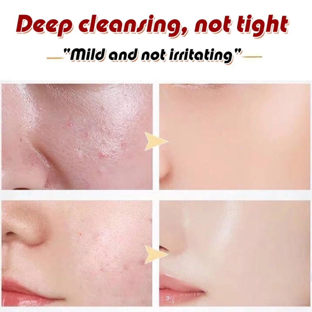 sup