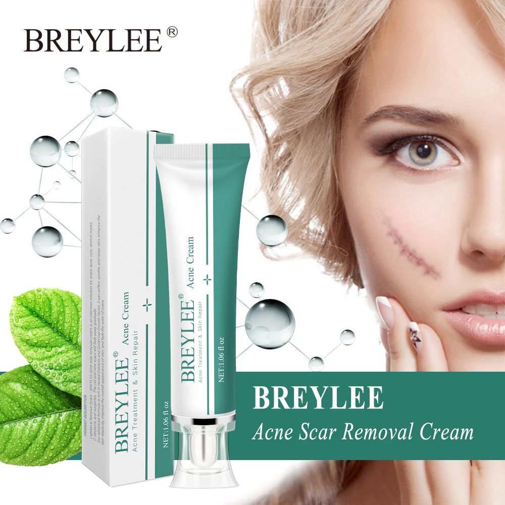 Scar Removal Cream Stretch Marks Acne Scars Skin Repair Dark Spot Remover Face Skin Care face cream,skin cream