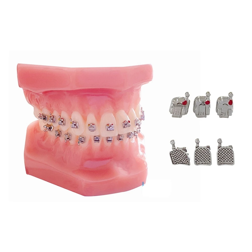 Рисунок 4 - KND ортодонтический металлический