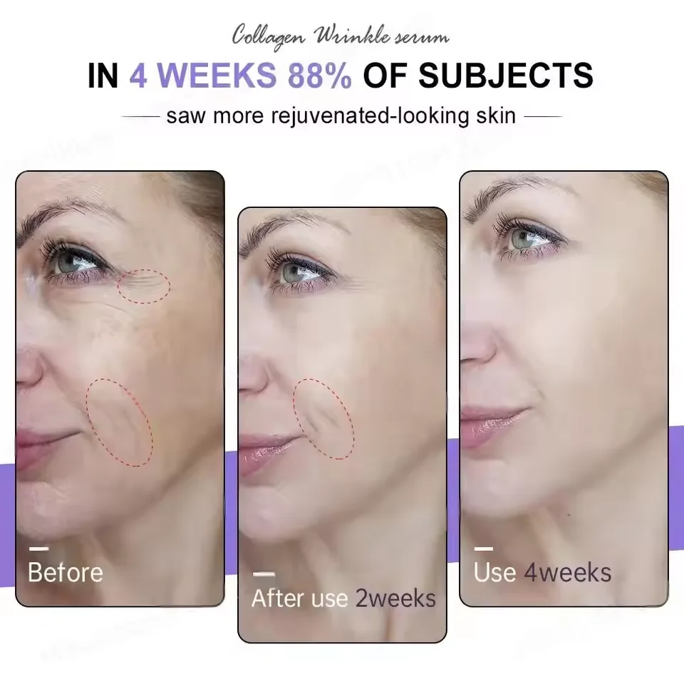Pure Hyaluronic Acid Remove Wrinkle Face Serum Firming Lift Anti-Aging Serum Fade Fine Lines Improve Puffiness Korean Skin Care 4
