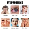 Wormwood Eye Patch Protect Eyesight Keep Good Vision dry itchy Eye Care Sticker Relieve Fatigue Myopic Massage Plaster 10pcs 5