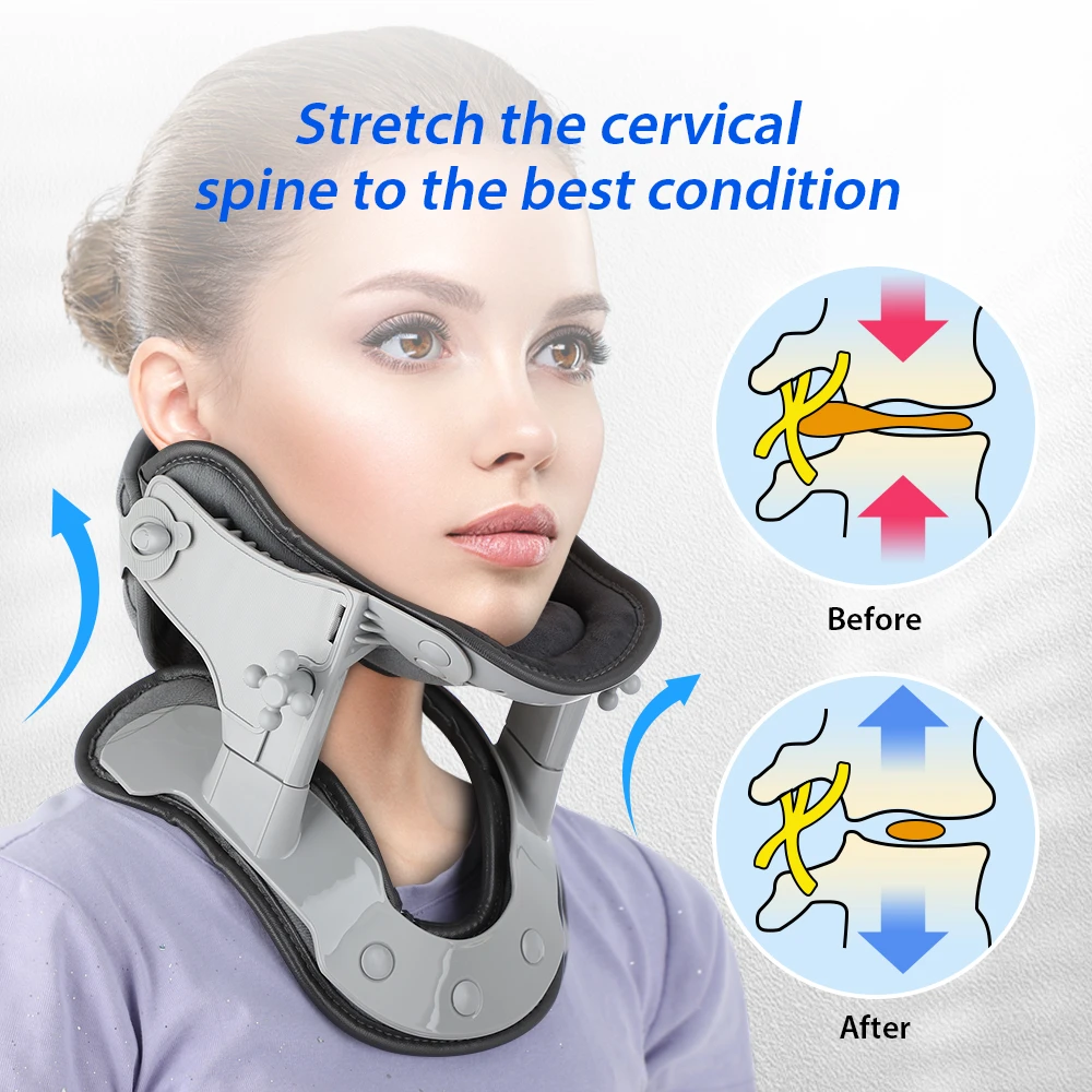 Cervical Spine Realignment And Restoring Loss Of Cervical Lordosis