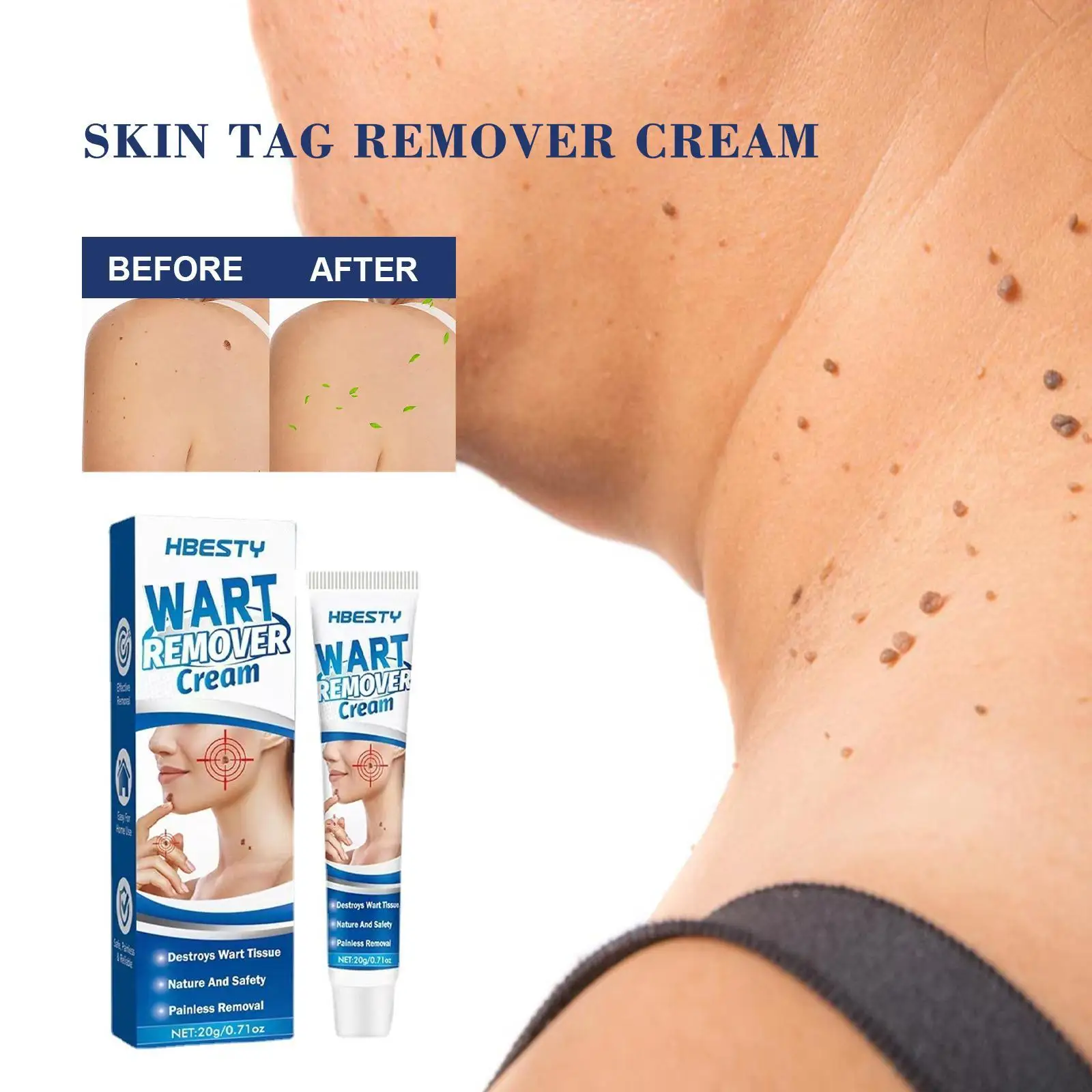 

Skin Tag Remover Cream Painless Mole Skin Dark Spot Warts Remover Serum Freckle Face Wart Tag Treatment Removal Essential Oil