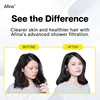 High Pressure Filtered Shower Head - Advanced Filtration for Hair, Skin & Nails - Reduces Itchiness, Blemishes, Dryness Black 5