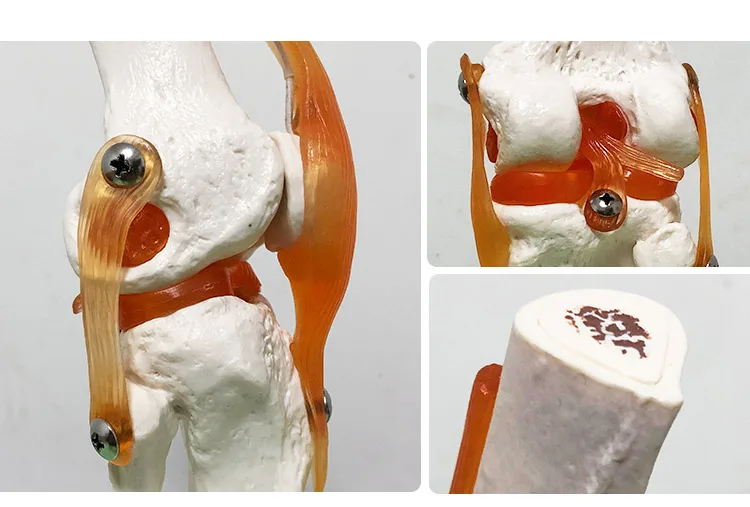 Human Skeleton Joint Anatomy Models Knee Elbow Foot Hand Shoulder Hip Joint with Ligaments Medical Science Teaching Supplies