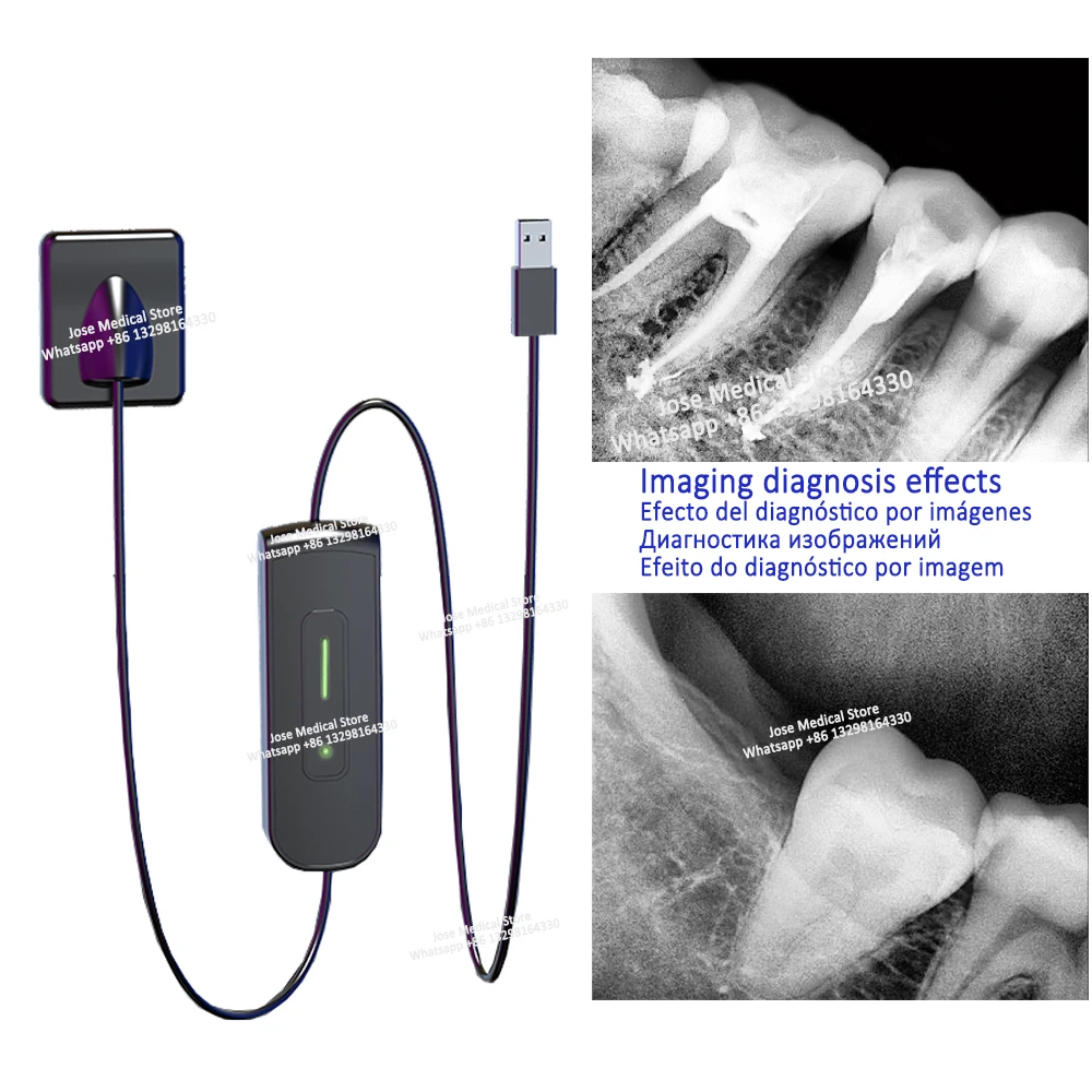 

Cheap Price Dental X-ray Sensor Rayos Dynimage CMOS RVG Intraoral Digital System HD Image for Dental Digital Imaging