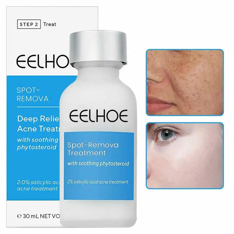 Acne Removal Day Cream Pimple Scar Shrink Pore Spot remover Deep Relief