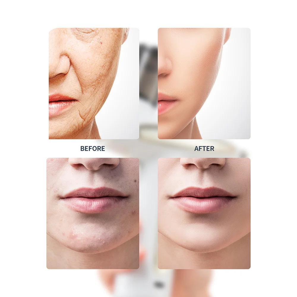 Portable Airbrush LED Red Blue Light Oxygen Injection Nano Mist Sprayer Deep Hydrating Face Humidifier Skin Moisturizing