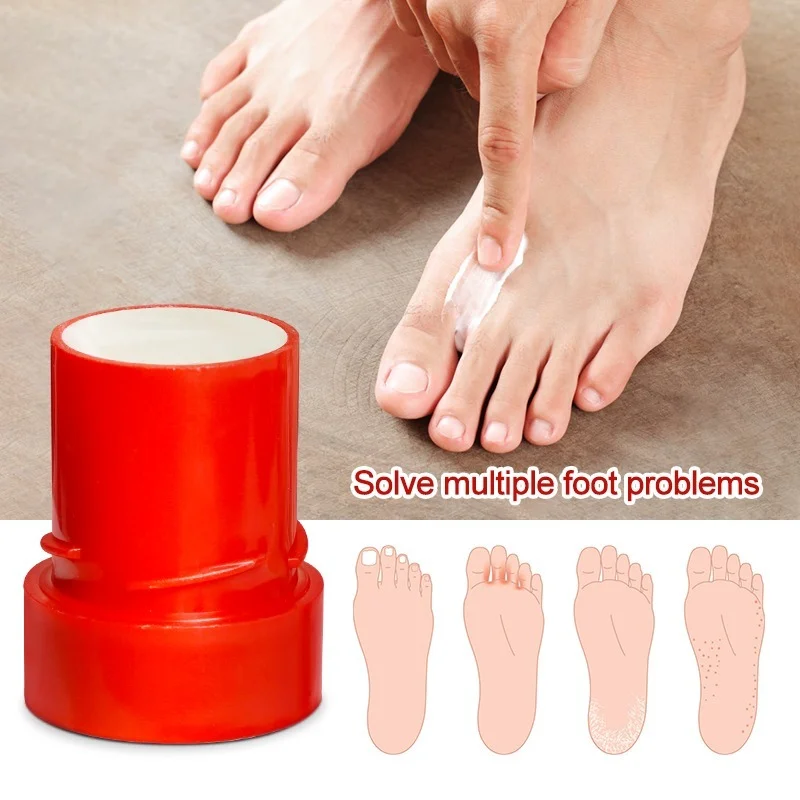 Foot Cream Anti bacterial Rotten Skin Peeling Itchy Blisters Remove