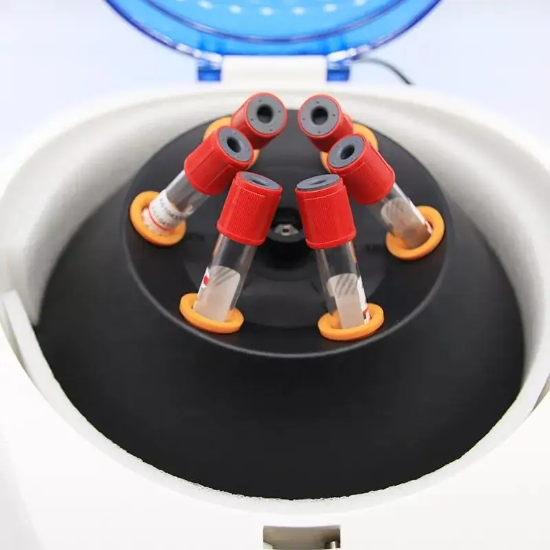 IKEME 저속 원심분리기, 의료 용품, Prp 플라즈마 원심분리기, 혈액 치과 원심분리기, 300-5000rpm