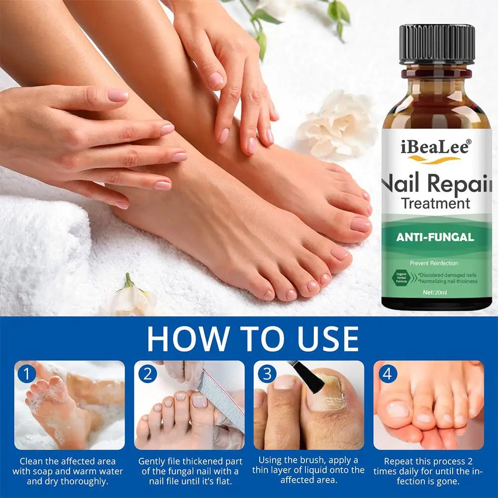 

20m Lnail Fungal Treatment Feet Care Essence Nails Removal Anti Repair Foot Fungus Infection Nail Paronychia Toe Oils A1f9