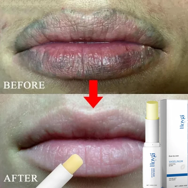 Instantly Lip Balm Remove Dark Lighten Melanin Lip Mask Fade Lip Line Brighten Exfoliating Moisturize Dead Skin Repair Lip Care 2