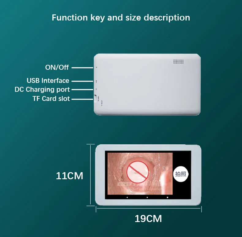 Mini Colposcope with Digital Video for Accurate Link PC Monitoring Health Monitors Accesorios Medicos Selectable Add Pad