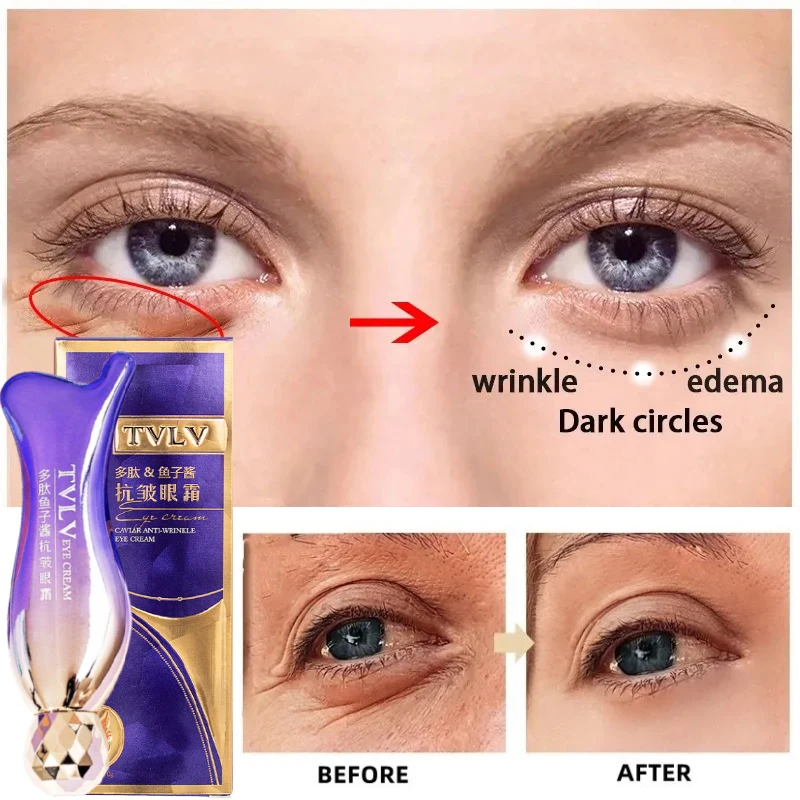 Magic Anti Wrinkle Eye Cream Lighten Fine Lines Anti Black Circles Serum Remove Eye Puffiness Anti-Aging Firming Eye Care 30g 24k gold snails eye cream peptide collagen cream roll on essence remove black circle wrinkles firming repair eye serum makeup