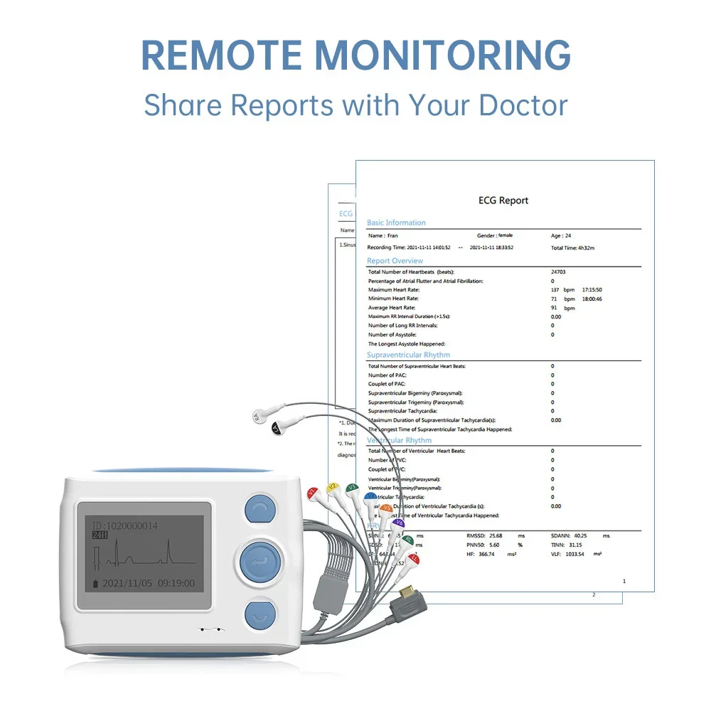 12-Lead Holter Monitor ECG EKG,24 Hours Dynamic ECG EKG Monitoring Detect Arrhythmias With AI Analysis
