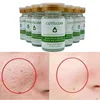 Oligopeptide Repairing Face Serum Facial Anti-Wrinkle Anti-Aging Firming Whitening Acne Treatment Lift Korean Skin Care Products 1