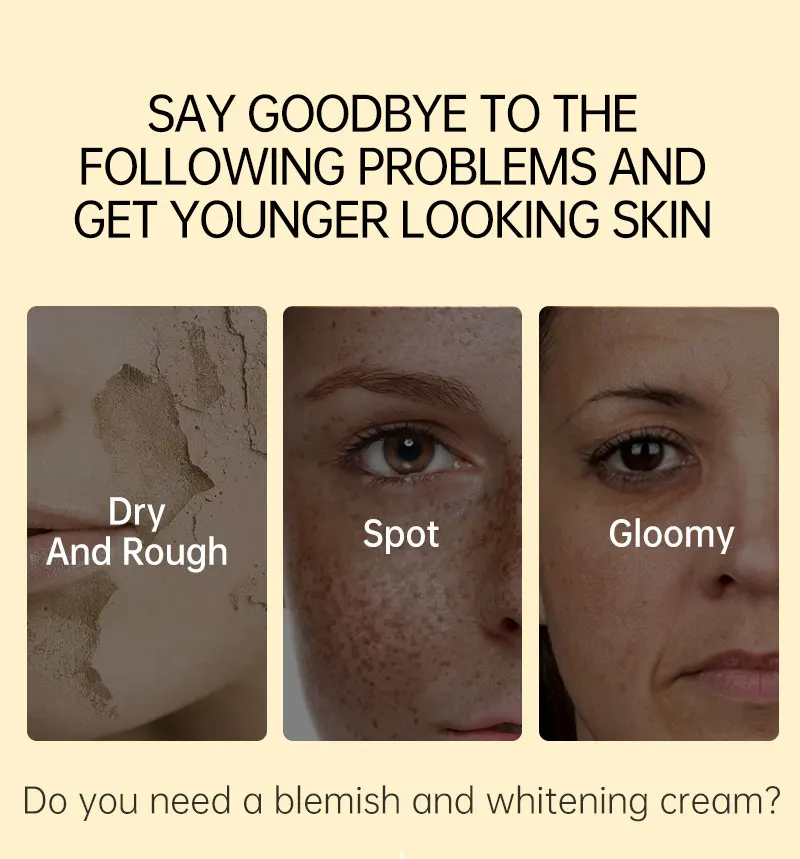 dark spot remover cream