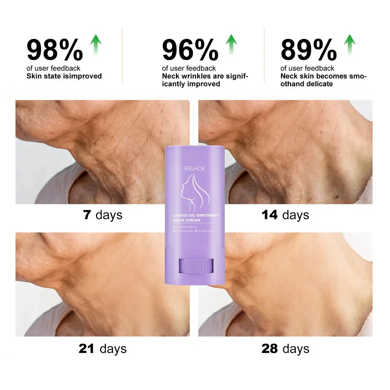 Neck Cream Moisturis Lift Neck Eliminate Double Chin Eliminate Fine Lines Anti-ageing Brightening Moisturizer