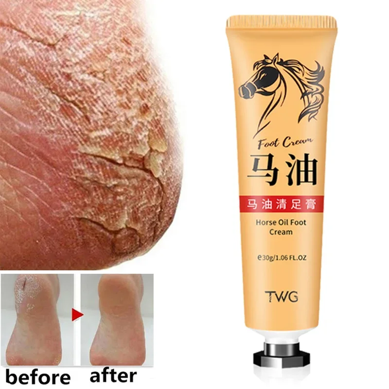 30g Horse Oil Cream Anti Crack Foot Cream Heel Cracked Repair Smooth Removal Dead Skin Callus Anti-Drying Hand Feet Skin Care horse feathers words are dead 1 cd