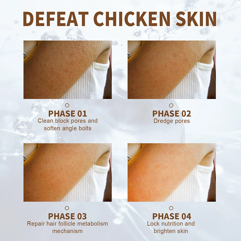 30g Hair Week Body Repair Cream Chicken Follicle Skin Repair Cream Moisturizing Nourishing Skin Care Supplies For Women Men