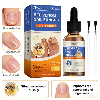 Soluzione per la Cura delle Unghie Anti-Infezione, Riparazione Onicomicosi, Essenza per la Cura di Unghie Danneggiate e Screpolate di Mani e Piedi, 50ml