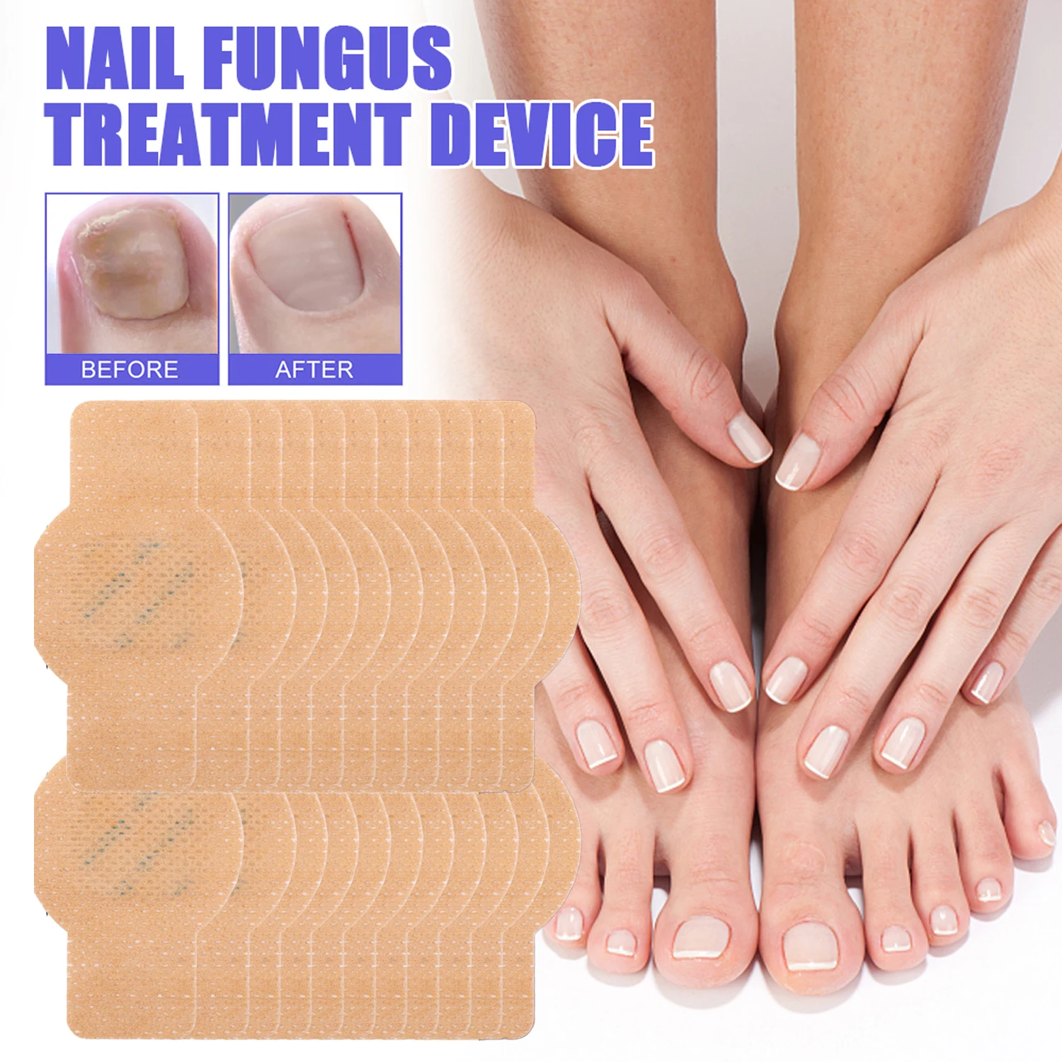 Ingrown Toenail Correction Patch Waterproof Nail Repair Tool Set_voghion.com