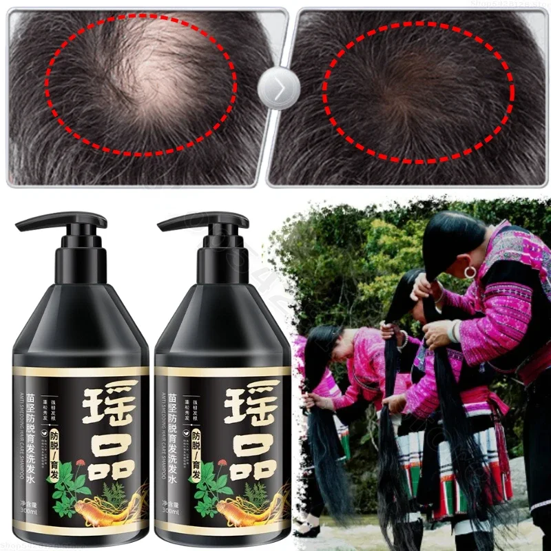 

Yao Pin Anti-stripping Shampoo Herbal Shampoo Improving White Hair Loss, Anti-dandruff, Anti-itching and Compliant Oil Control