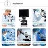 Wholesale Blood Capillary Nailfold Capillaroscopy Color Microcirculation Detector/Video Capillaroscope 5