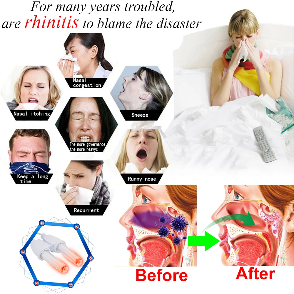 Rhinitis Sinusitis Cure Therapy Machine Nose Care Bionase Rinite Massage Device Laser Treatment Health Care nose treatment