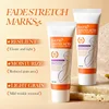44716-6715cc.jpg Stretch Mark Repair Cream – Firm, Smooth & Restore Skin