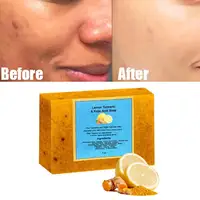 1/2/3/4/5PCS-100g Savon artisanal naturel au curcuma et citron, procédé à froid, infusé au gingembre, barre nettoyante douce pour le soin de la peau 5
