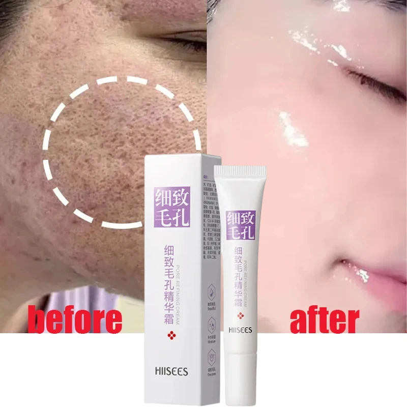 Salicylic Acid Pore Shrinking Cream Quick Elimination Large Pores Remove Blackehead Tighten Face Smooth Skin Korean Care Product salicylic acid pore shrinking cream quick eliminate large pores remove blackehead tighten repair face smooth skin care products