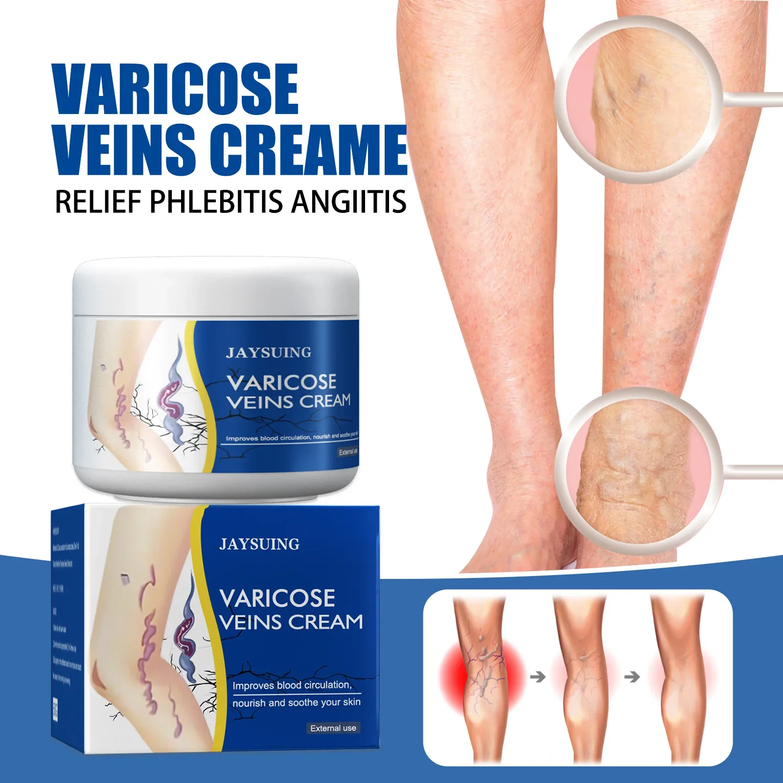 cross border vein repair patch relieves leg varicose pain earthworm bulging veins and pulse healing patch Venous repair cream earthworm leg bulging veins relieving pain red blood streaks moisturizing and repairing cream