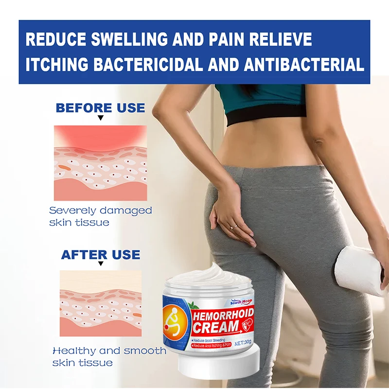 30g Hemorrhoids Removal Treatment Ointment Herbal Medicine Cream Internal Hemorrhoids Piles External Anal Fissure Health Care Hemorrhoids Treatment Cream
