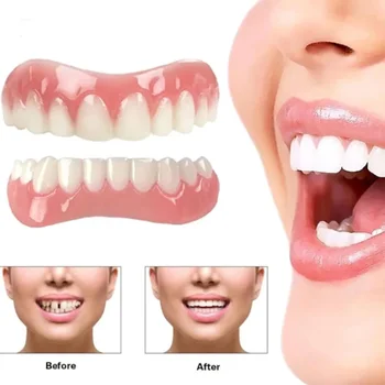 Silicone False Teeth Cosmetic Dental Veneer Men and Women Dentures Oral Hygiene Tools Dentures Veneers Dental Cosmetics 1