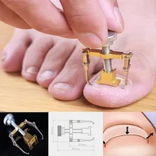 

Professional Ingrown Toenail Toe Fixer Recover Correction Device Protector Tool Pedicure Foot Nail Care