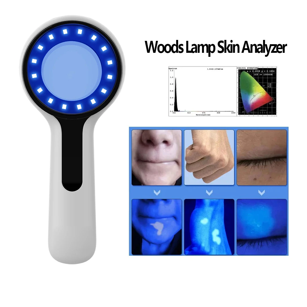 NEW Woods Lamp Skin Analyzer Portable Facial Salon Beauty Analyzer UV Lamp Wood Dermatology for Analyzing Testing Examination
