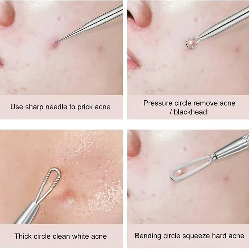 4Pcs/Set Acne Blackhead Needle Set Unscented Blemish PoreCleanser Needle Hook Spot Pimple Remover Skin Care Tools Accessories 5