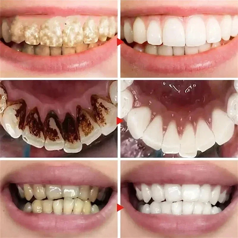 Teeth Whitening Product Teeth Whitening Essence V34 Teeth Whitening Toothpaste 5D Teeth Whitening Stick Oral Hygiene Cleaning Tool