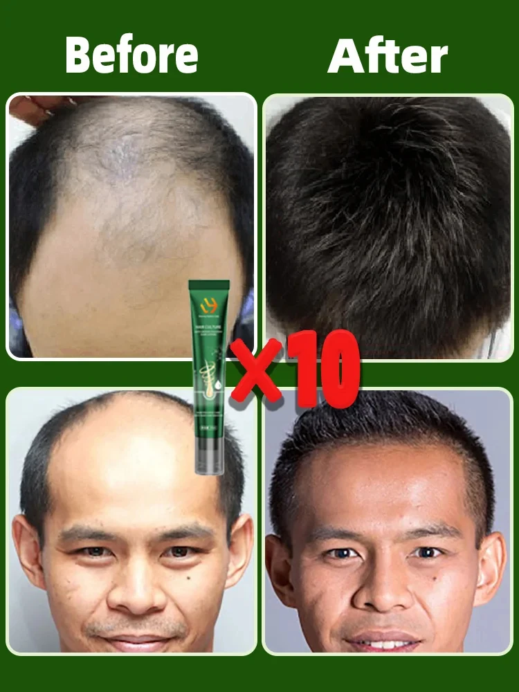 Hair Growth Products Hair Growth Products 2024 Repair Baldness Hair Loss