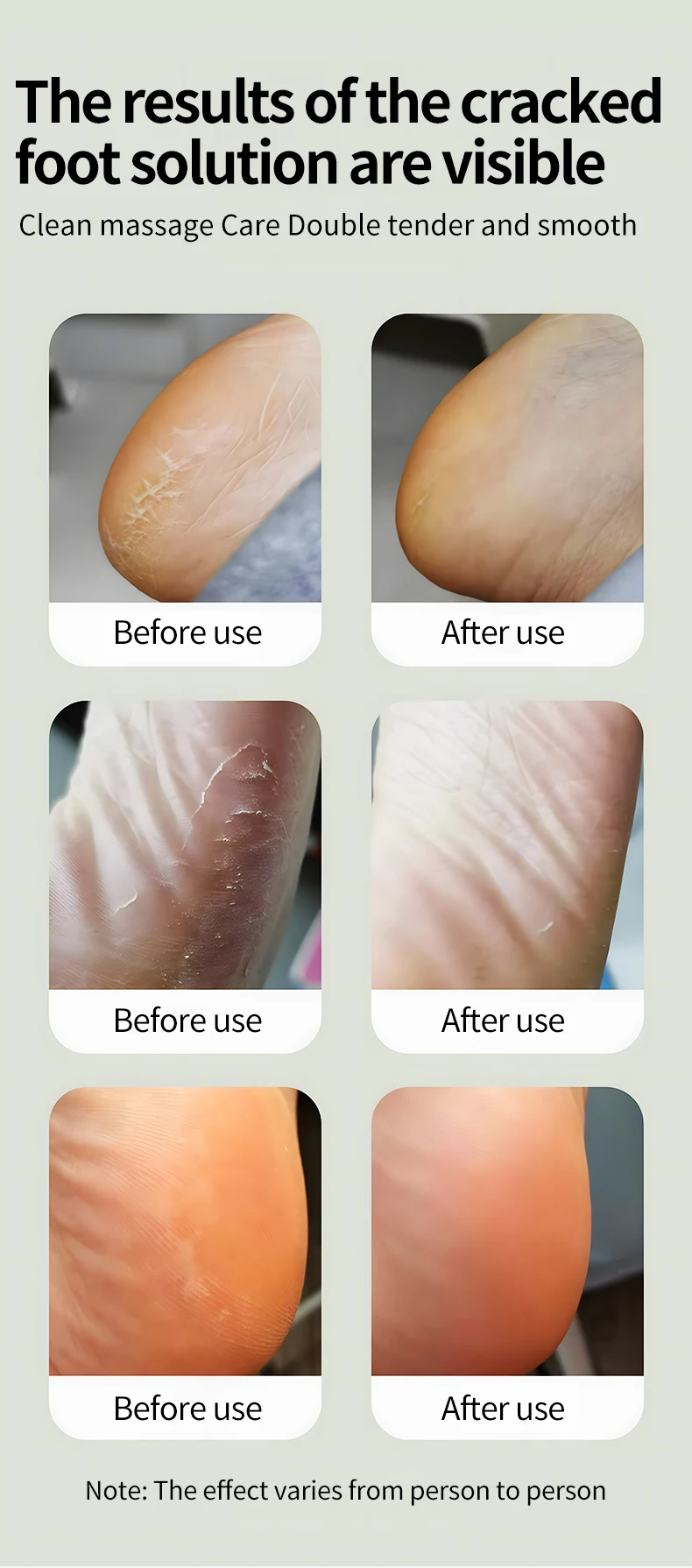 Cordless Electric Foot Callus Remover for Feet 6 Speeds with Replaceable Sandpap