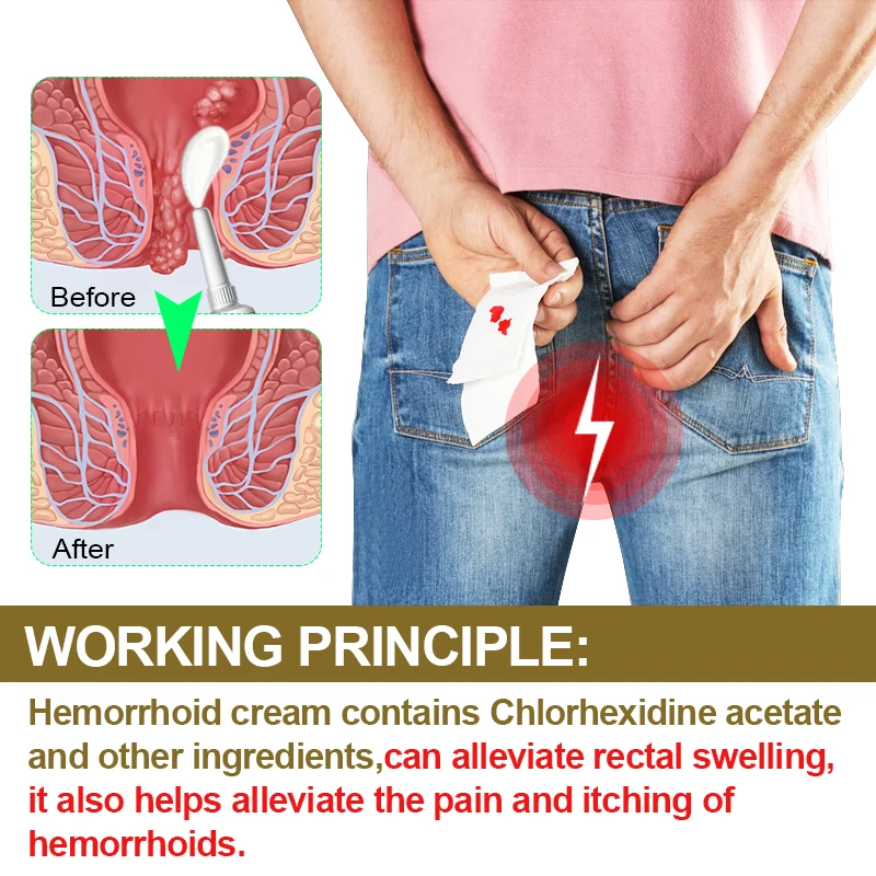 2Pcs Hemorrhoids Ointment Internal Piles External Anal Fissure Cream Relief Anal Pain Swelling Itch Chinese Medicine Cream A1956