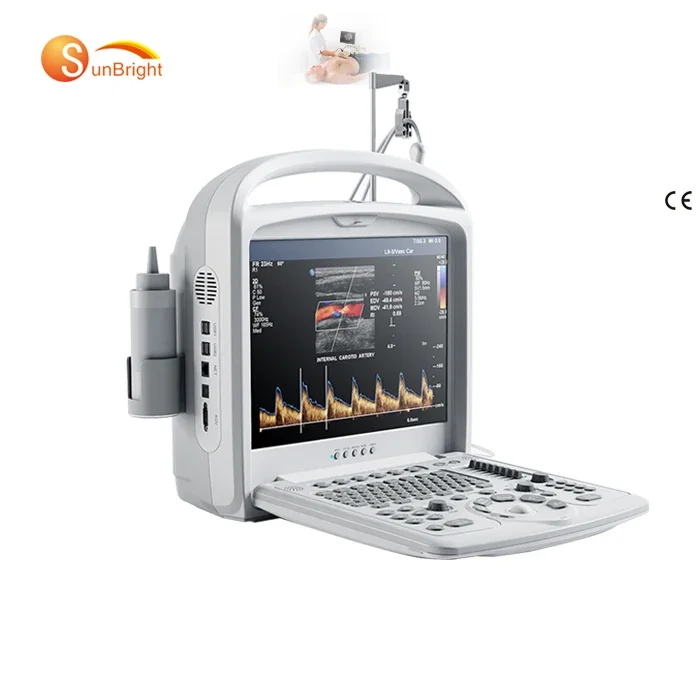 Sunbright Ultrasuoni Ecografo Portatil En Color Doppler De 3D / Escaner Portatile En Color