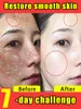 ᴮᵉˢᵗ ᶜʰᵒⁱᶜᵉ ᶠᵒʳ ᵇʳⁱᵍʰᵗᵉⁿⁱⁿᵍ ˢᵏⁱⁿ 1