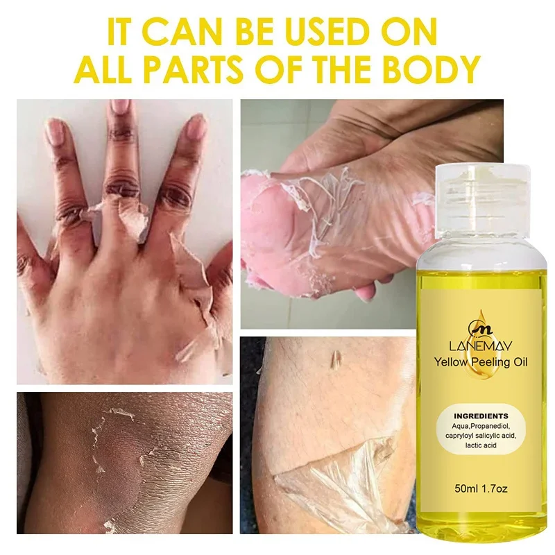 

Yellow Peeling Oil Dark Skin Bleaching Remove Arm Knee Legs Melanin Body Brighten Scrub Whiten Exfoliating Dead Skin Care Serum