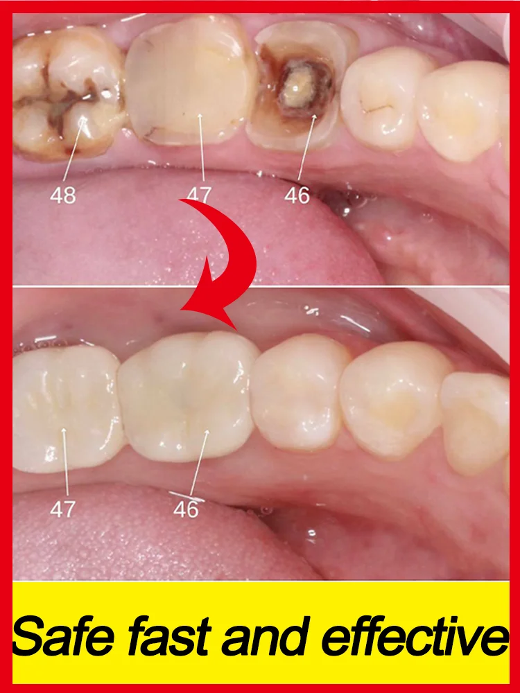 Spazzolino da denti disinfettante