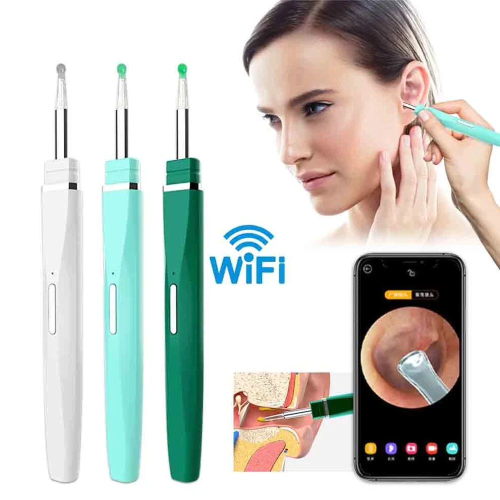 Wireless HD Smart Visual Ear Cleaner Wax Removal Tool Otoscope