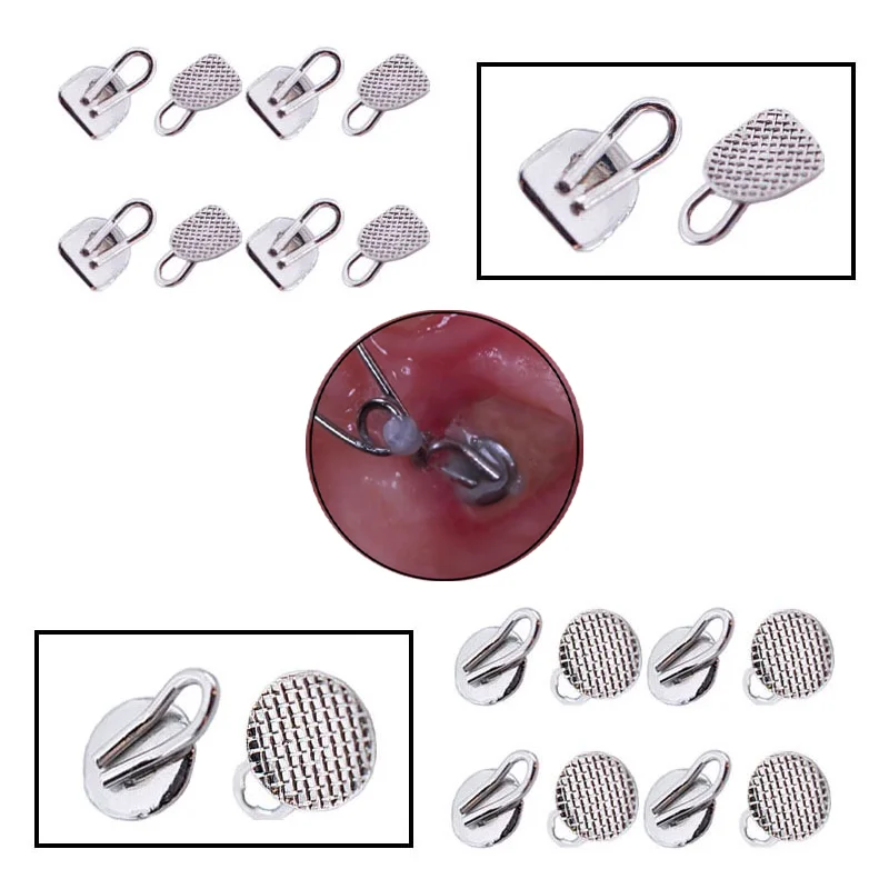 

10Pcs/Bag Dental Orthodontic Lingual Traction Hook Buttons Round Rect Metal For Brackets Ortodoncia Treament